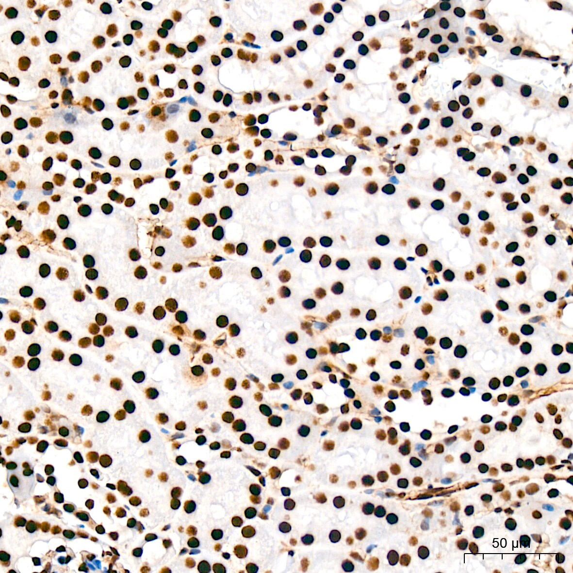 USP39 Antibody (1S9R9)