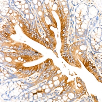 ROCK2 Antibody (8G3U2)