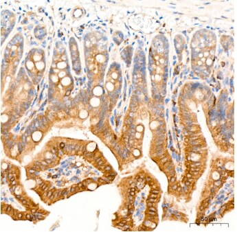ROCK2 Antibody (8G3U2)