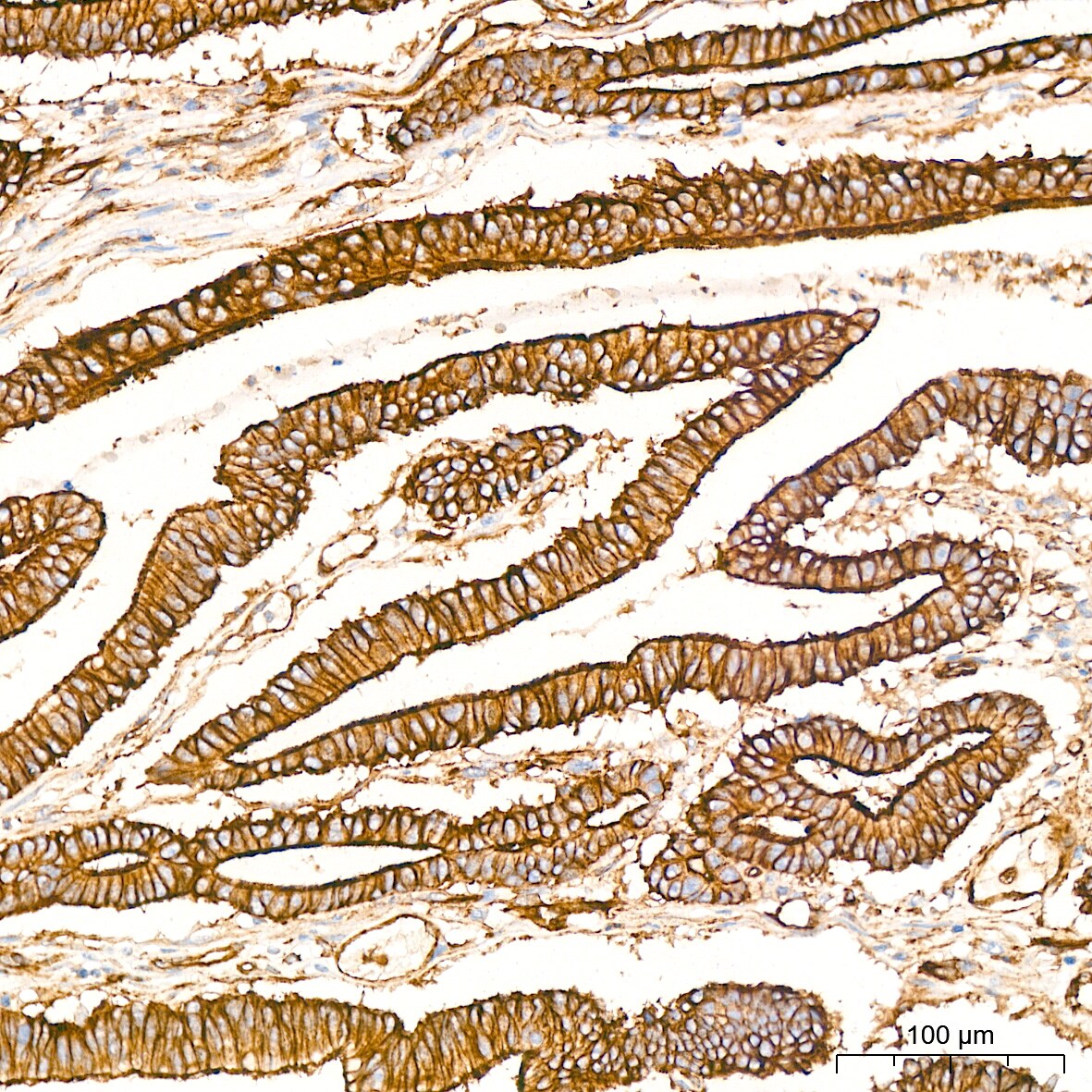 Alpha Fodrin Antibody (9H5V8)