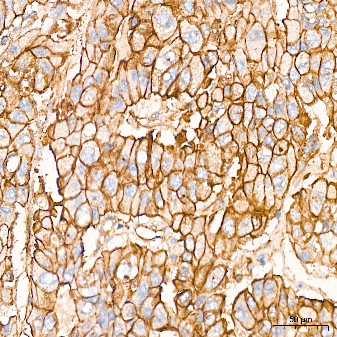 Alpha Fodrin Antibody (9H5V8)