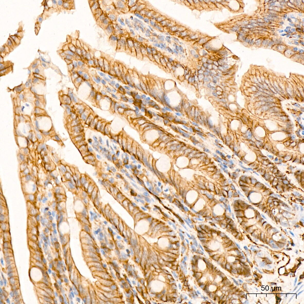 Alpha Fodrin Antibody (9H5V8)