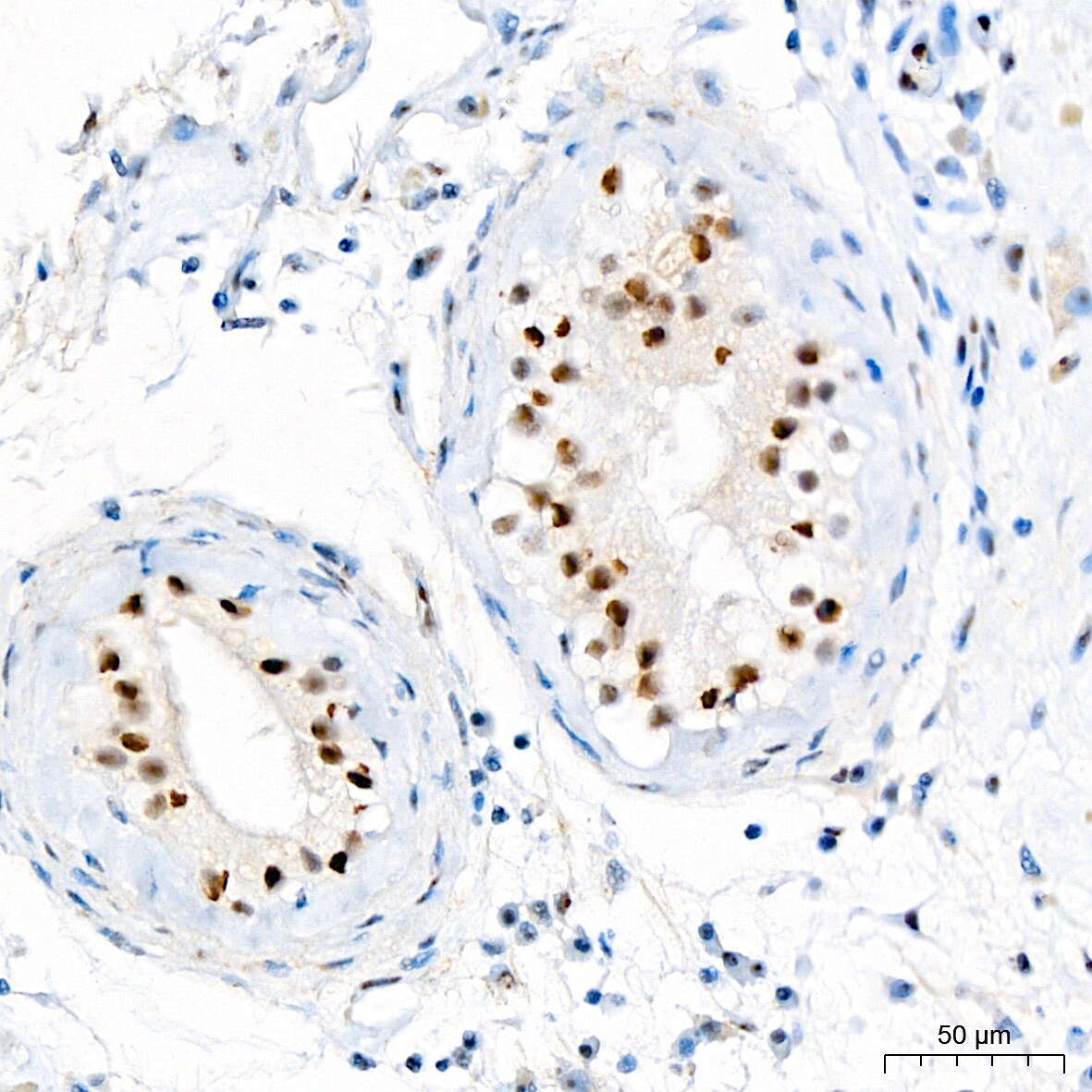 WT1 Antibody (6L9X6)