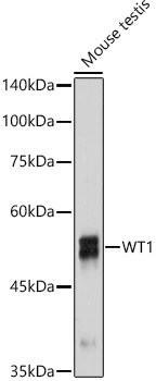 WT1 Antibody (6L9X6)