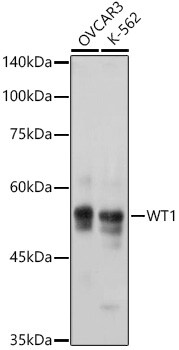 WT1 Antibody (6L9X6)