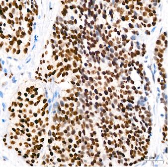 WT1 Antibody (6L9X6)