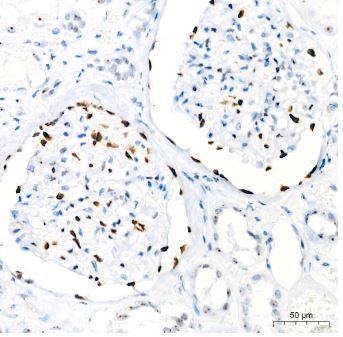 WT1 Antibody (6L9X6)