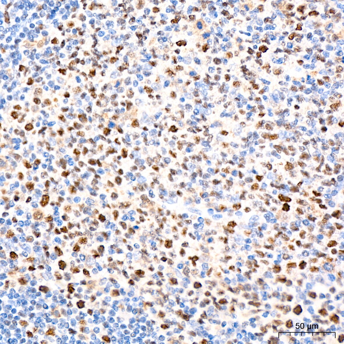 Nup153 Antibody (3I5V3)