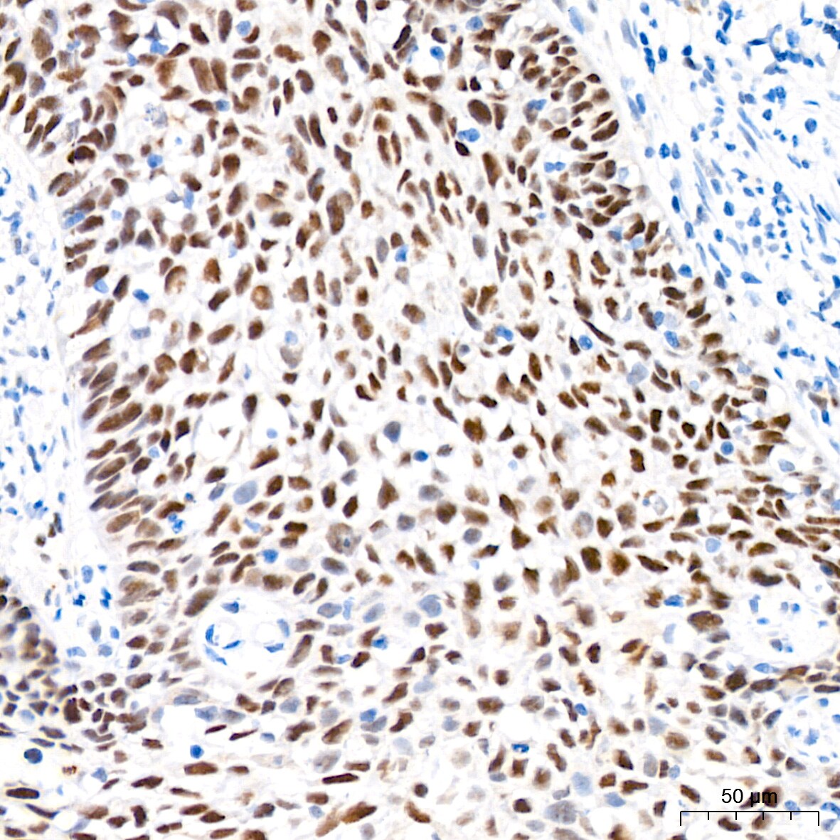 Nup153 Antibody (3I5V3)