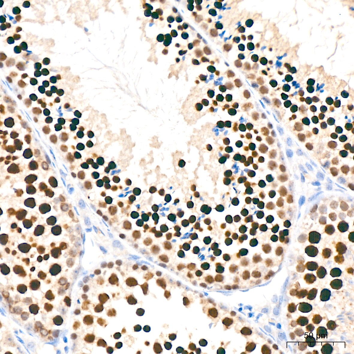 Nup153 Antibody (3I5V3)