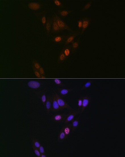 Nup153 Antibody (3I5V3)
