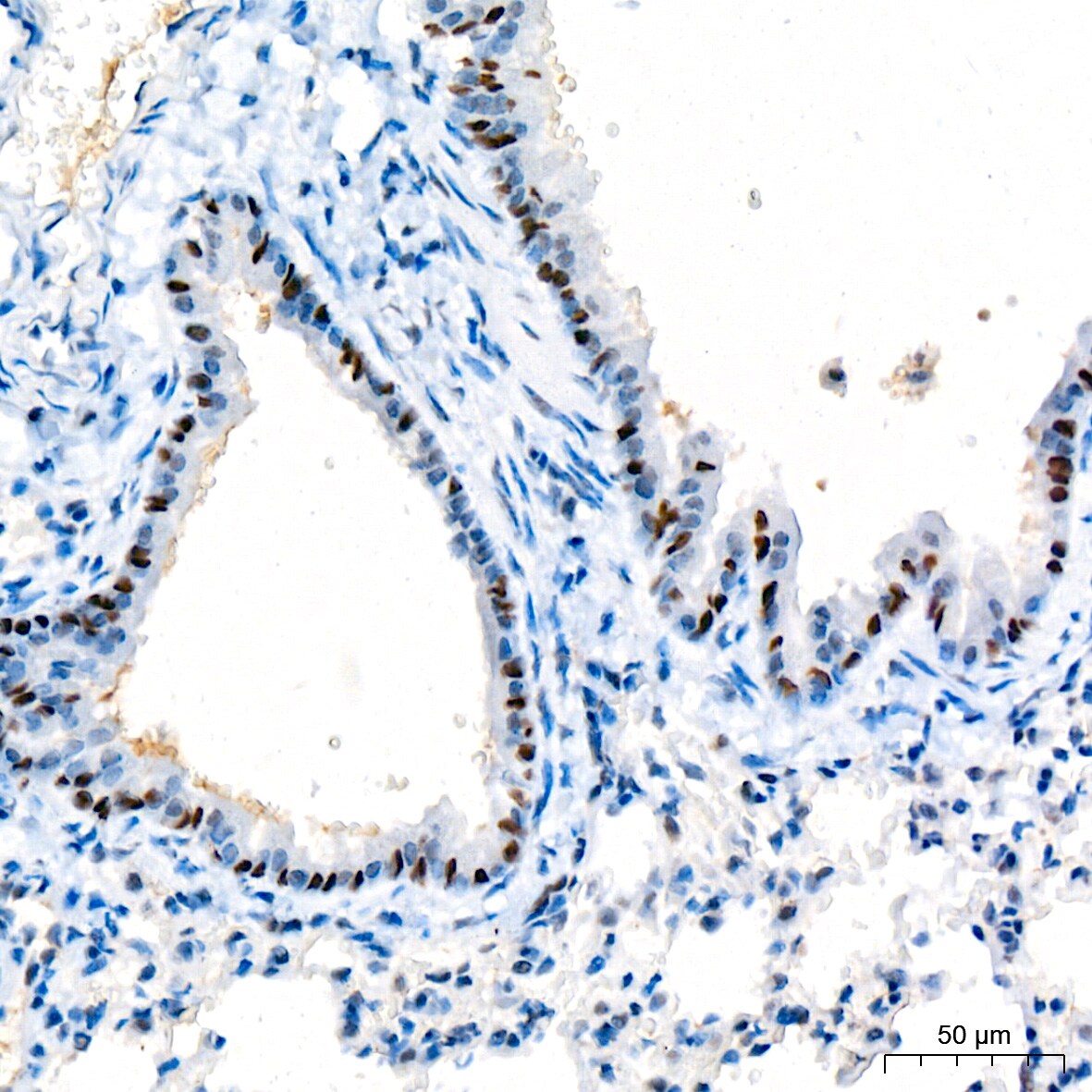 p73 Antibody (7L1V7)