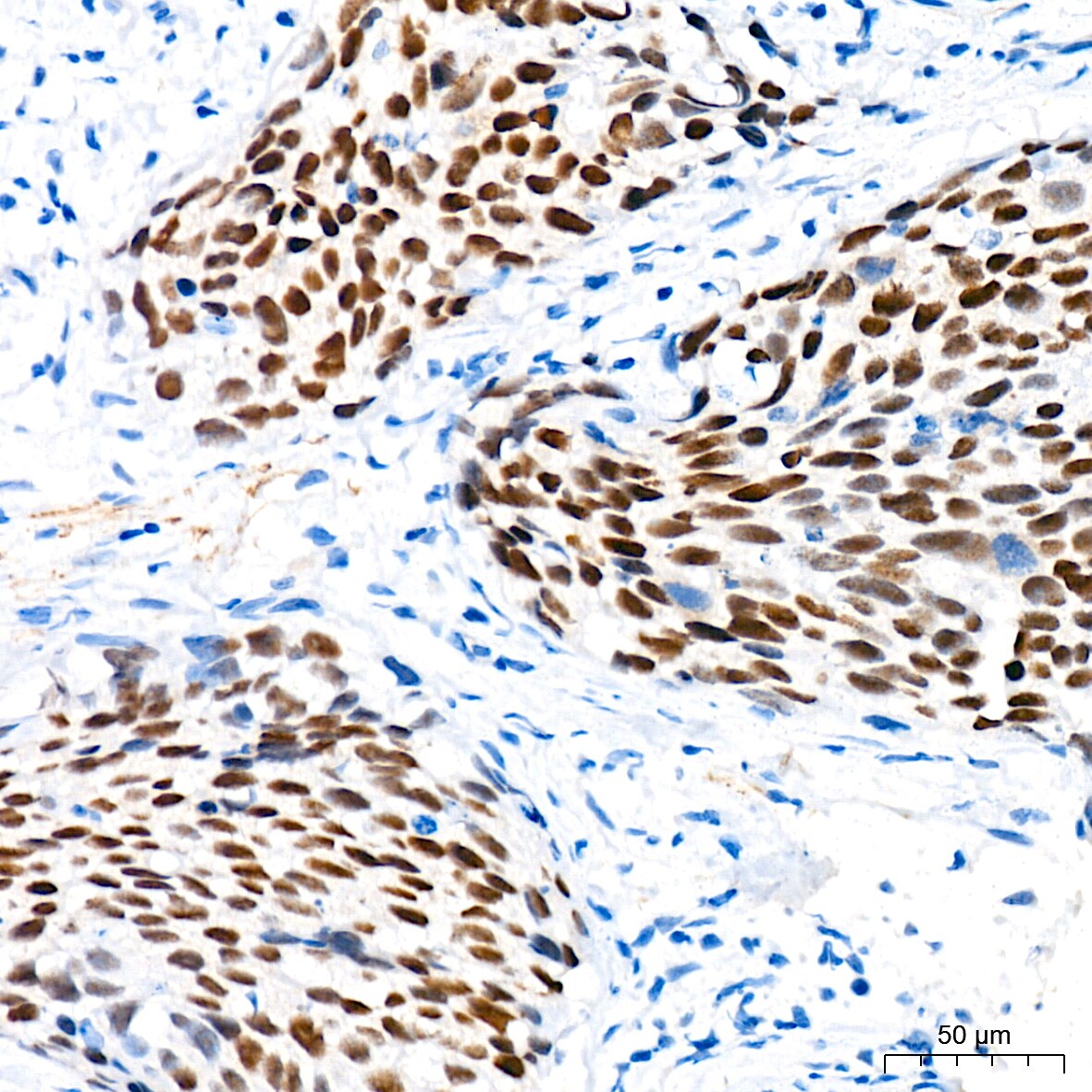 p73 Antibody (7L1V7)