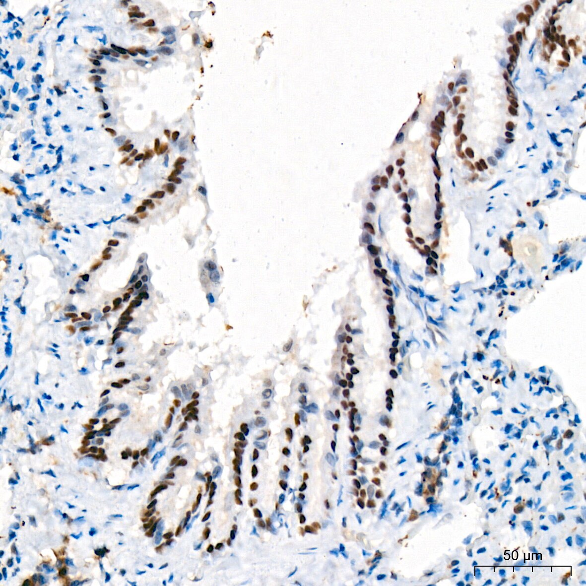 p73 Antibody (7L1V7)