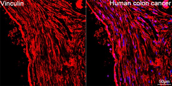 Vinculin Antibody (9I3Y8)