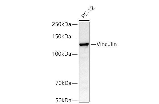 Vinculin Antibody (9I3Y8)