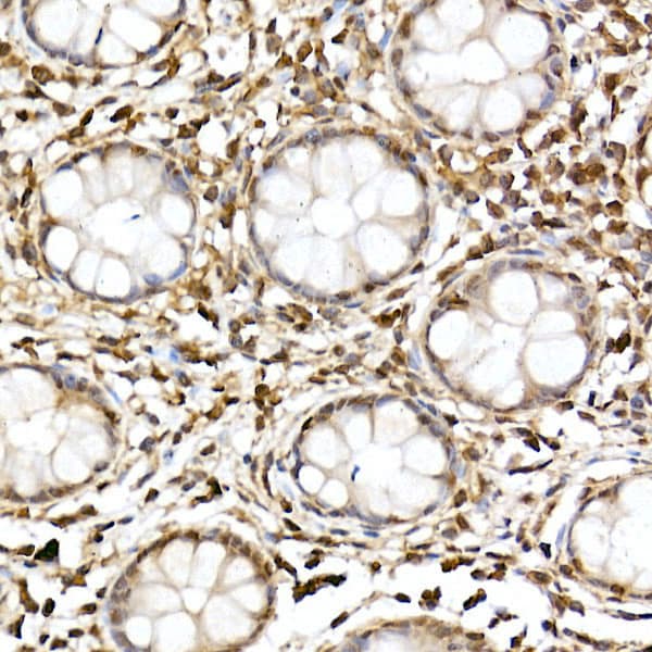 JNK1/2/3 Antibody - Azide and BSA Free