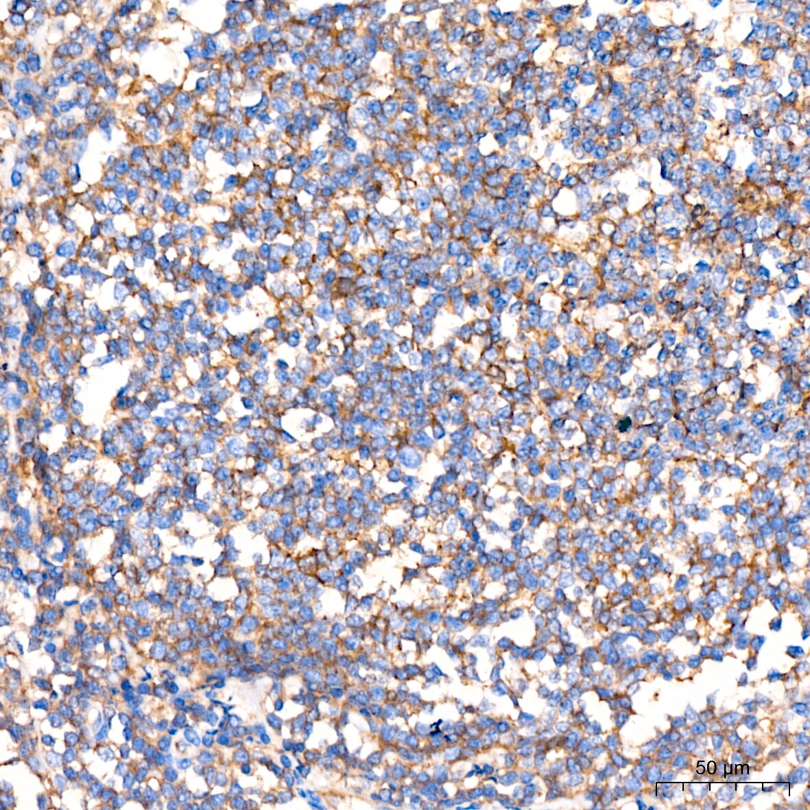 Flotillin-1 Antibody (8I2S7)