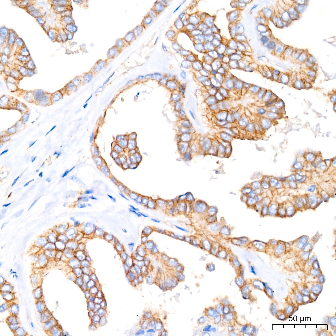 Flotillin-1 Antibody (8I2S7)