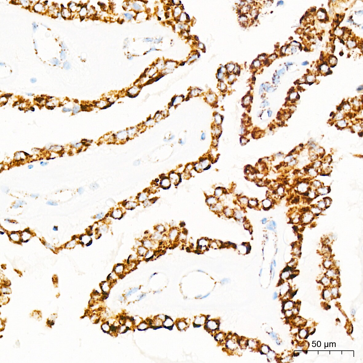 mtTFA Antibody (4H2M9)