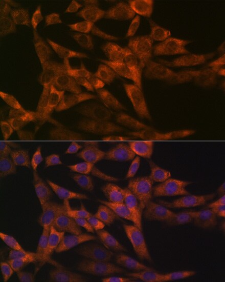 IRF6 Antibody (5D1Z4)