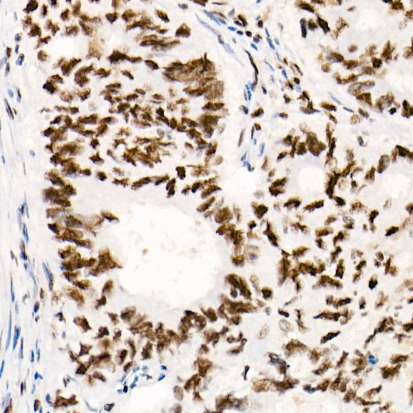 SNF5 Antibody (9A9G0)