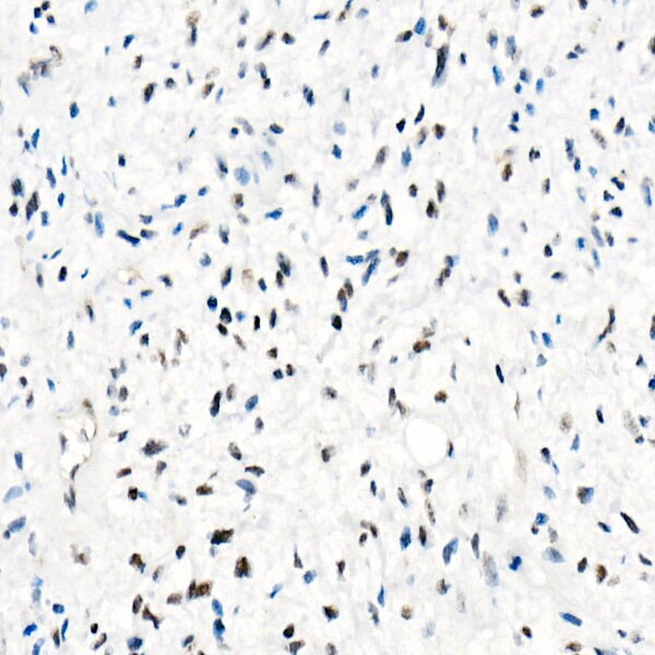SNF5 Antibody (9A9G0)