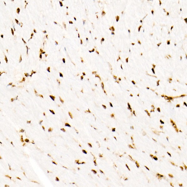 SNF5 Antibody (9A9G0)