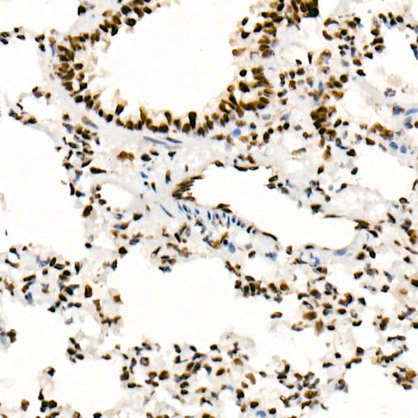 SNF5 Antibody (9A9G0)