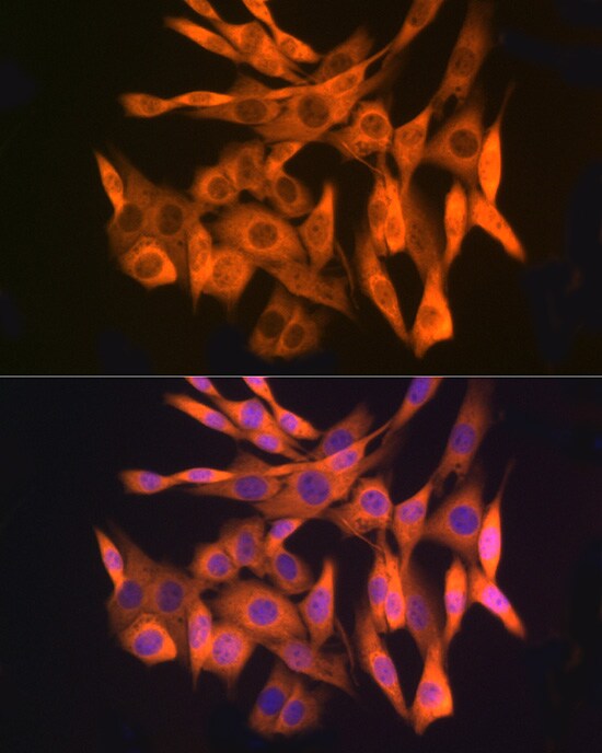 GLI-3 Antibody (8B1E2)