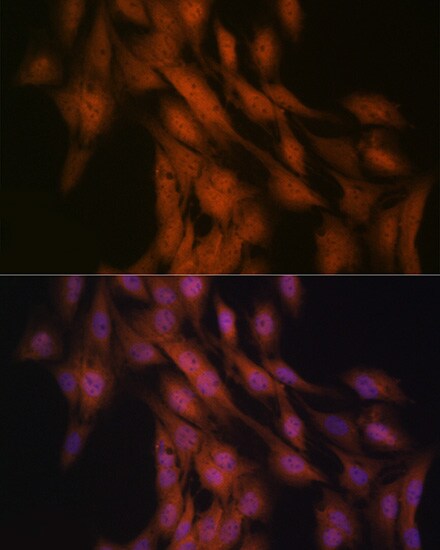 GLI-3 Antibody (8B1E2)