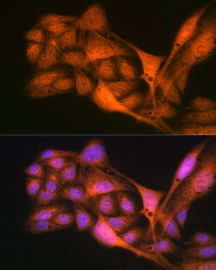 GLI-3 Antibody (8B1E2)