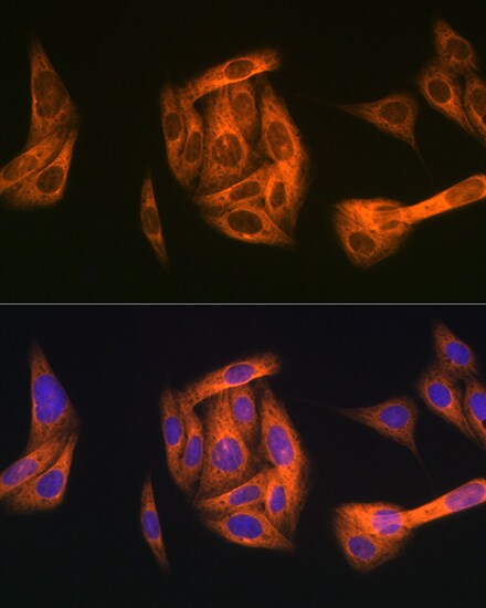 TAB1 Antibody (2W0P2)