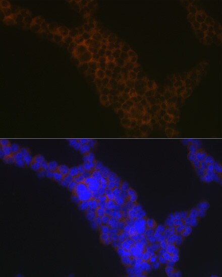 LSP1 Antibody (4U10N5)