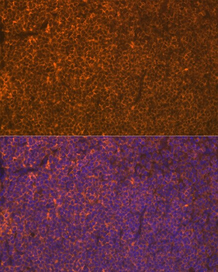 LSP1 Antibody (4U10N5)