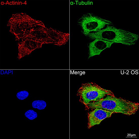 Alpha Actinin 4 Antibody (5Y3R6)