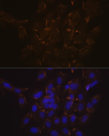 Phospholipid Scramblase 1/PLSCR1 Antibody (5U6G1)