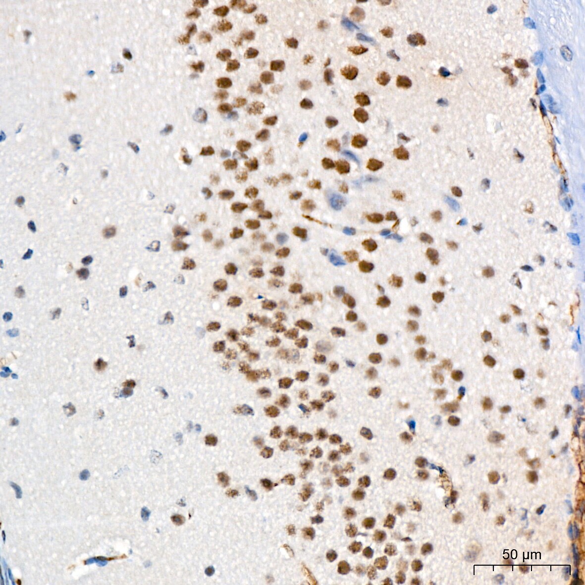 USP7 Antibody (3J7G1)