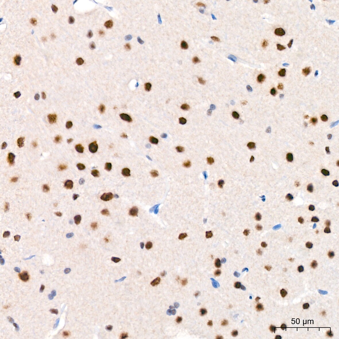 USP7 Antibody (3J7G1)