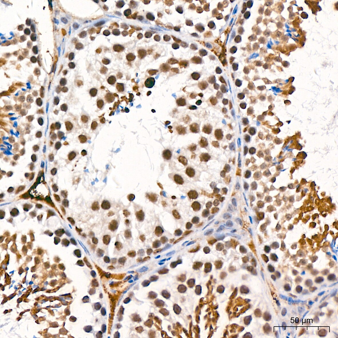 USP7 Antibody (3J7G1)