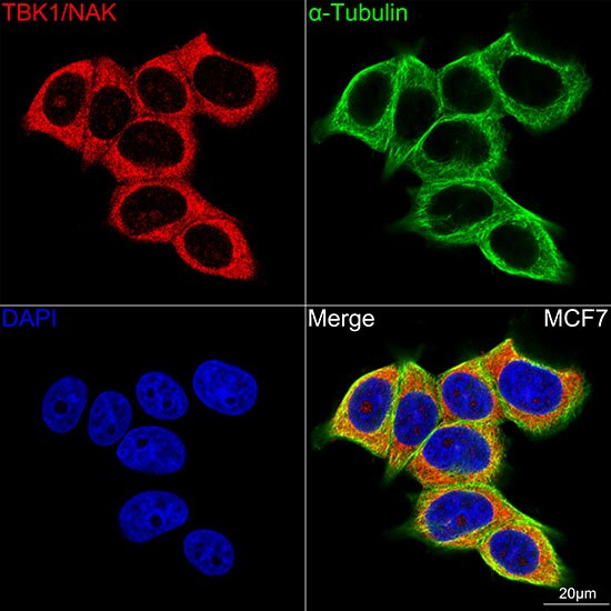 TBK1 Antibody (4G6C7)