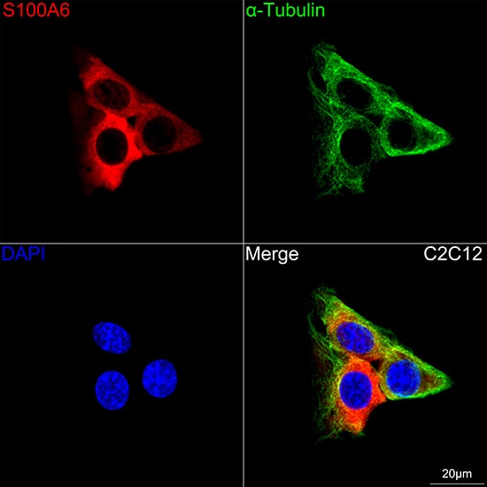 S100A6 Antibody (0J1Q5)