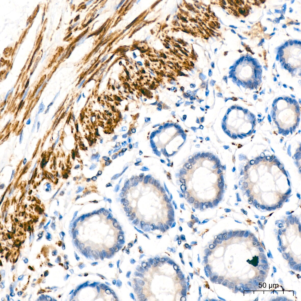 IKK epsilon/IKBKE Antibody (5N4J8)