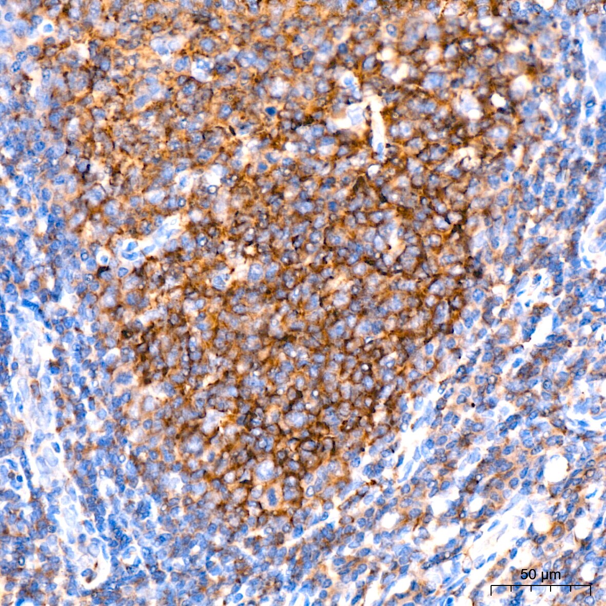 IKK epsilon/IKBKE Antibody (5N4J8)