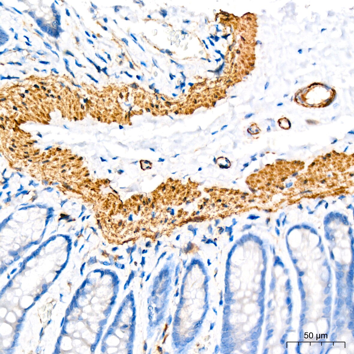 IKK epsilon/IKBKE Antibody (5N4J8)