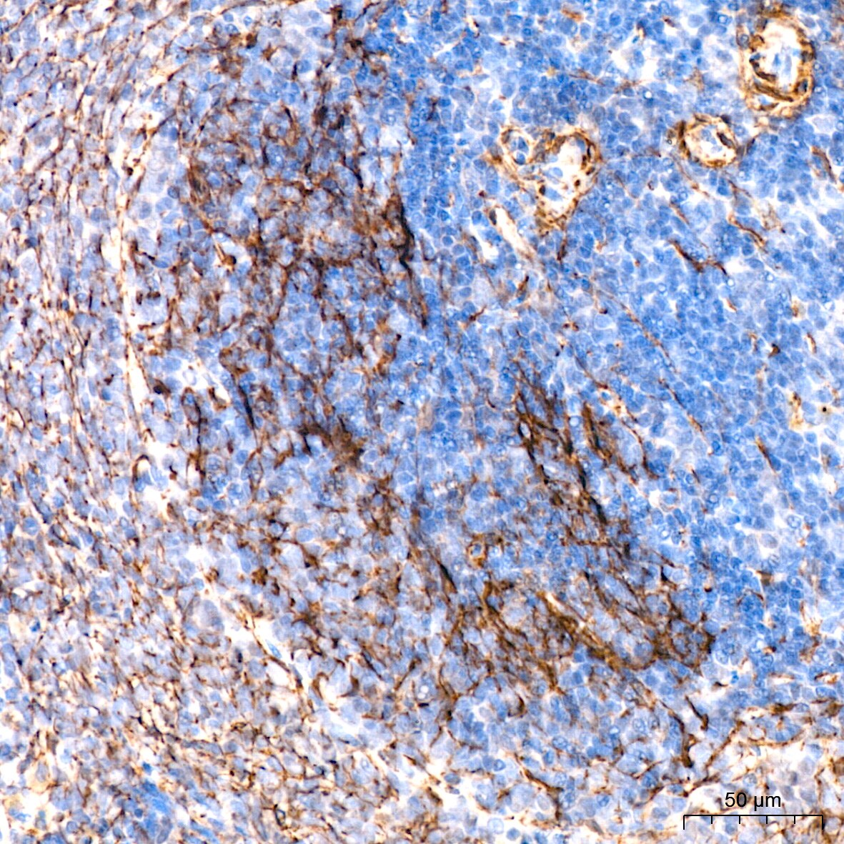 IKK epsilon/IKBKE Antibody (5N4J8)