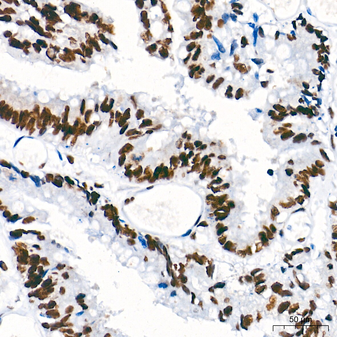 PTBP1 Antibody (9M6A8)