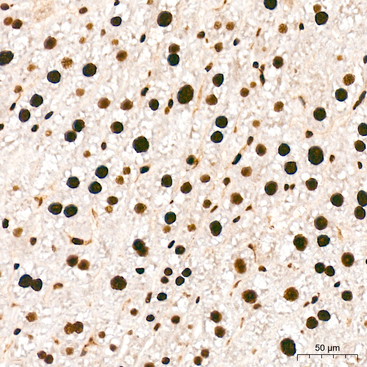 ANP32B Antibody (4A8E5)