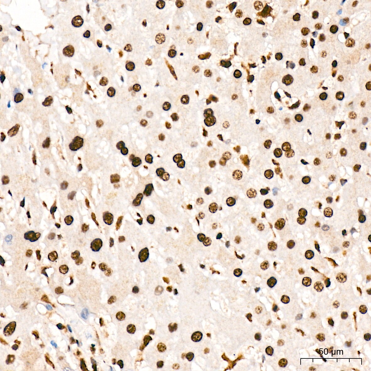 ANP32B Antibody (4A8E5)