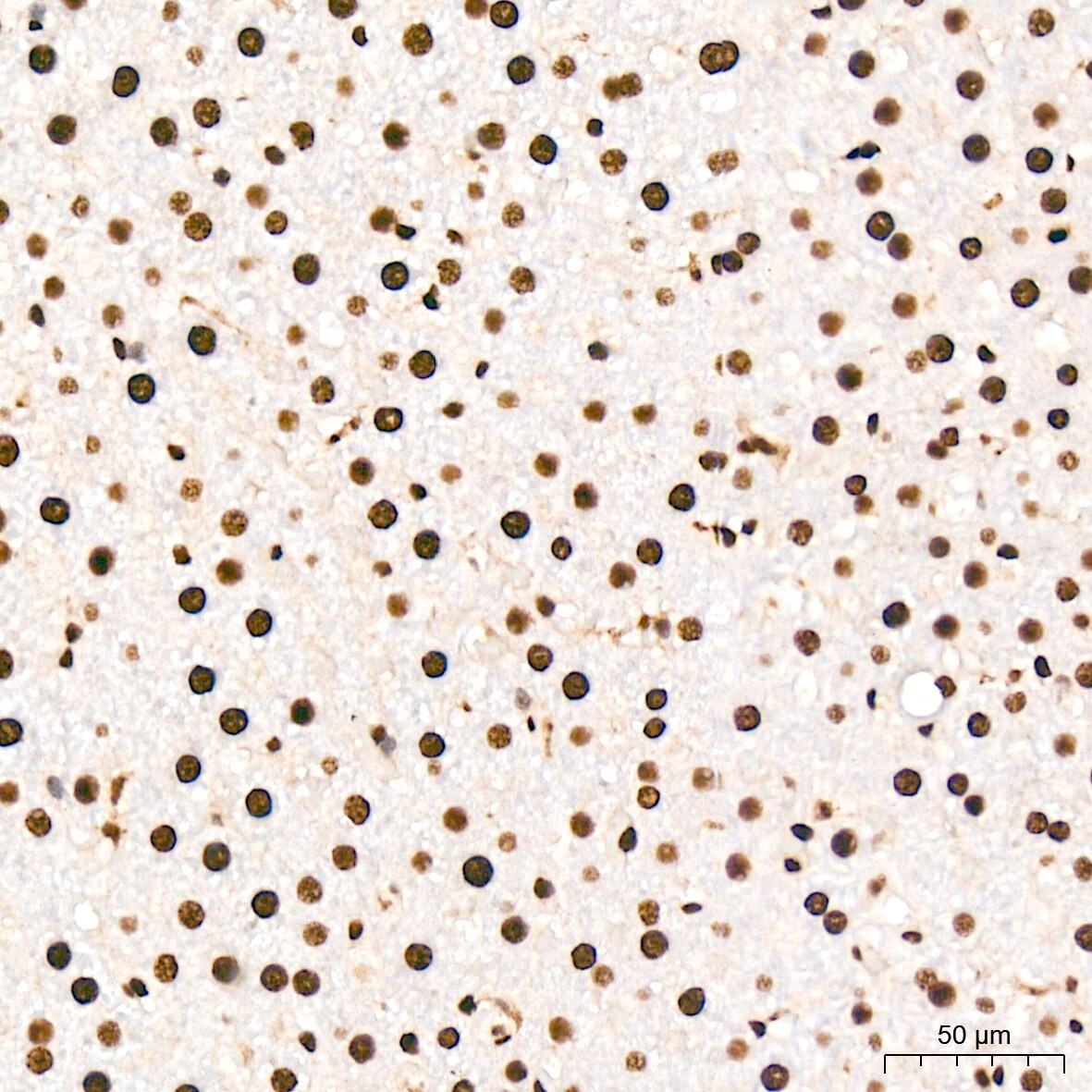 ANP32B Antibody (4A8E5)